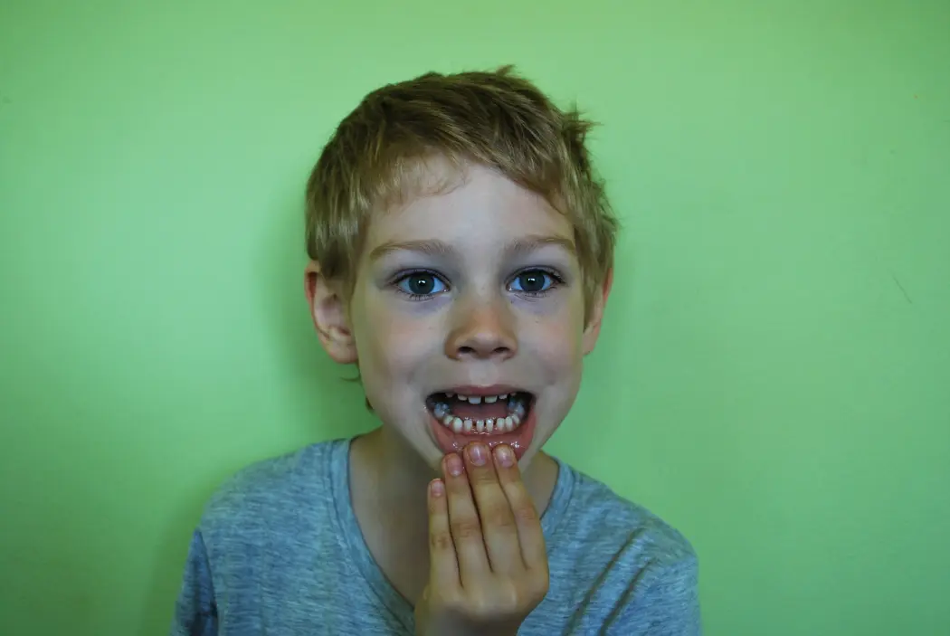 Przeglądy jamy ustnej u dzieci – sposób na zdrowe zęby już od pierwszego roku życia